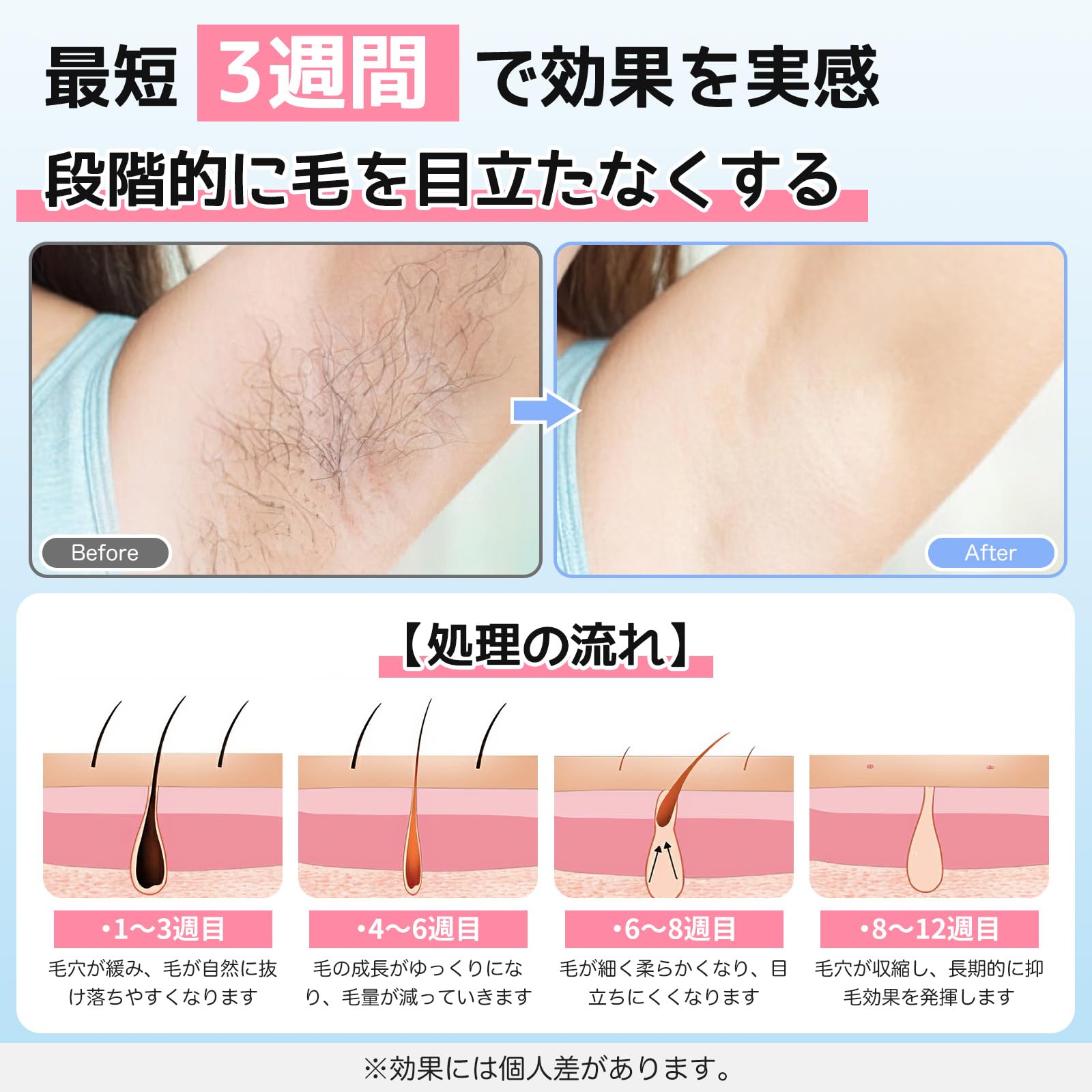 ▲最終値下げです 光脱毛器☆新品☆未開封 Amazon | 脱毛器 家庭用 IPL 光脱毛器【2026 新登場・冷感ケア搭載】90